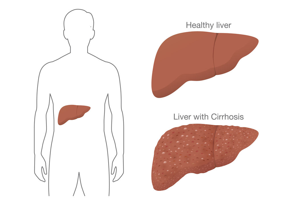 signs your liver is healing from alcohol